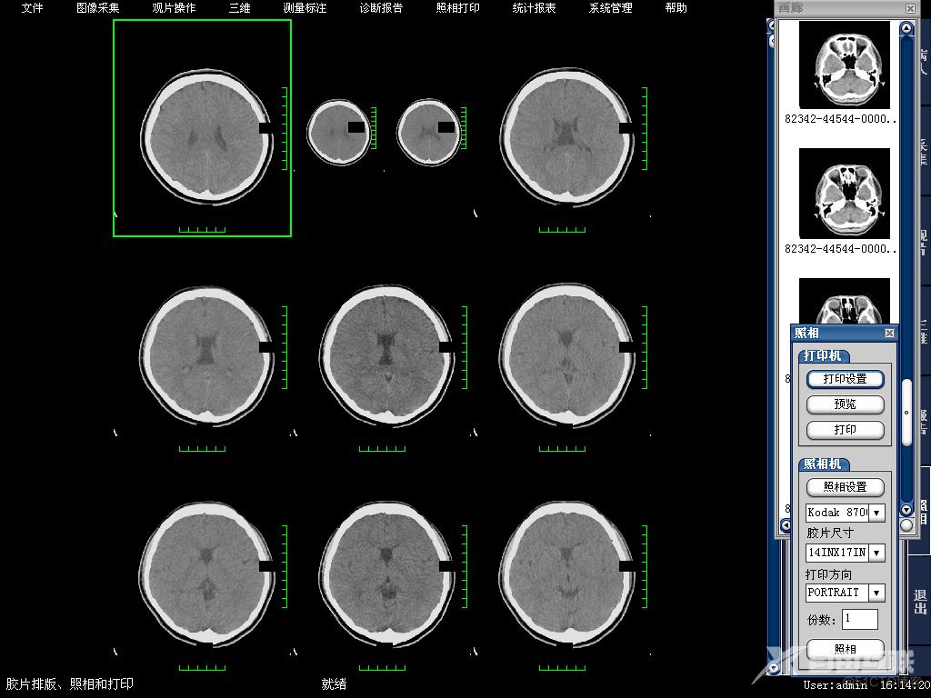 医学影像MRI，CT和X-ray概述和成像原理_灰度