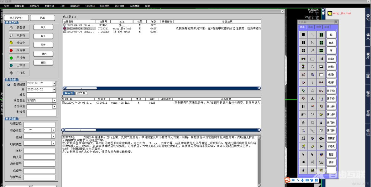 C++医院PACS系统工作原理_数据_02