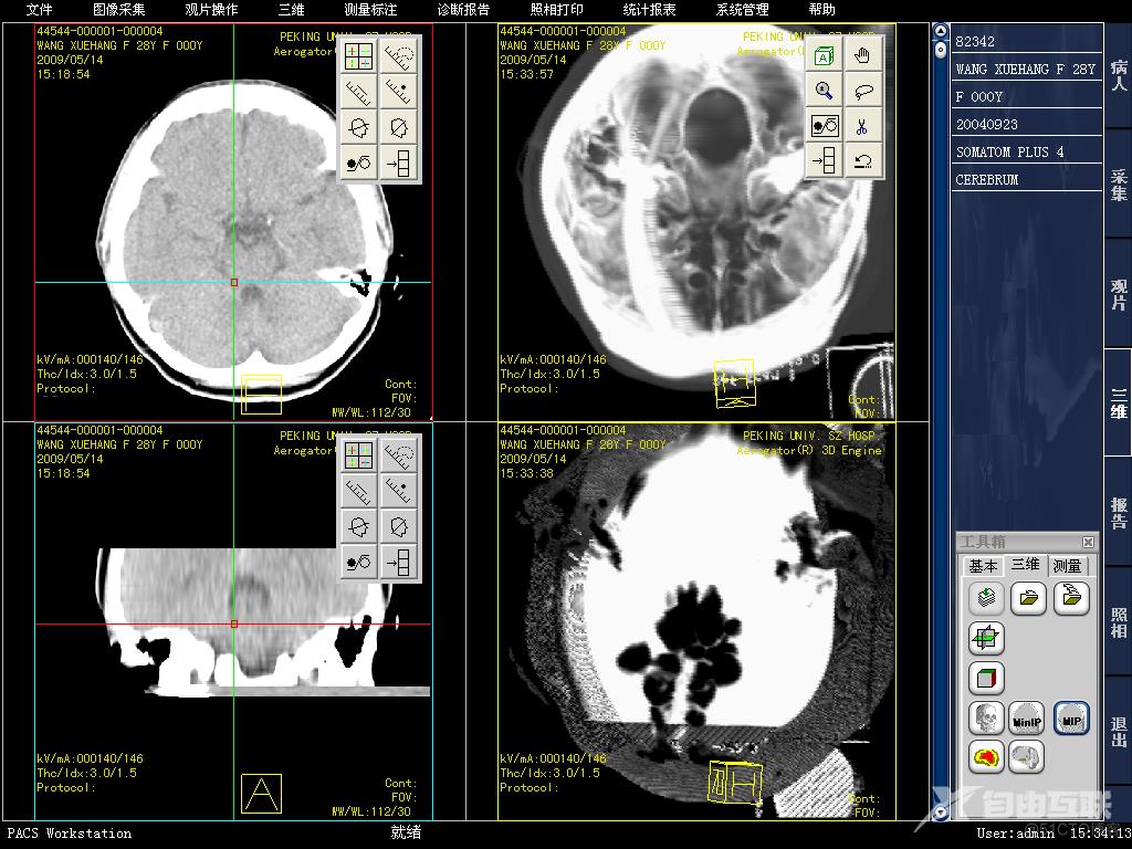 PACS影像技术基础-----CT-MRI图像的特点和应用_灰度_02