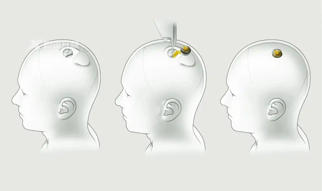 涉嫌虐待动物，马斯克的脑机接口公司面临联邦调查插图1