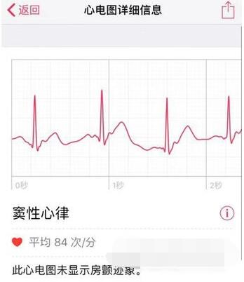 AppleWatch7怎么查看心电图数据？AppleWatch7心电图数据查看方法截图