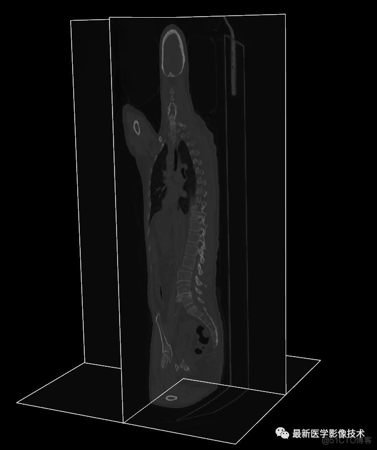 医学图像处理案例（四）——生成人体骨骼和肺组织三维模型_3d