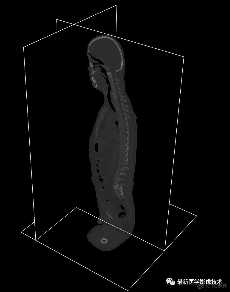 医学图像处理案例（四）——生成人体骨骼和肺组织三维模型_ico_03