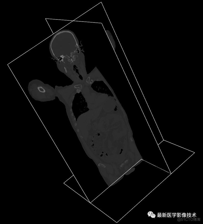 医学图像处理案例（四）——生成人体骨骼和肺组织三维模型_第三方工具_04