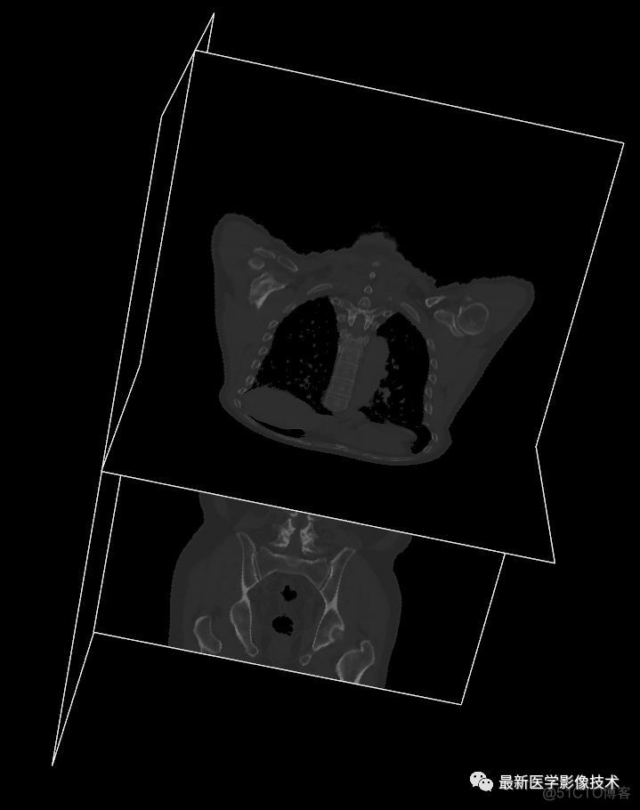 医学图像处理案例（四）——生成人体骨骼和肺组织三维模型_第三方工具_05