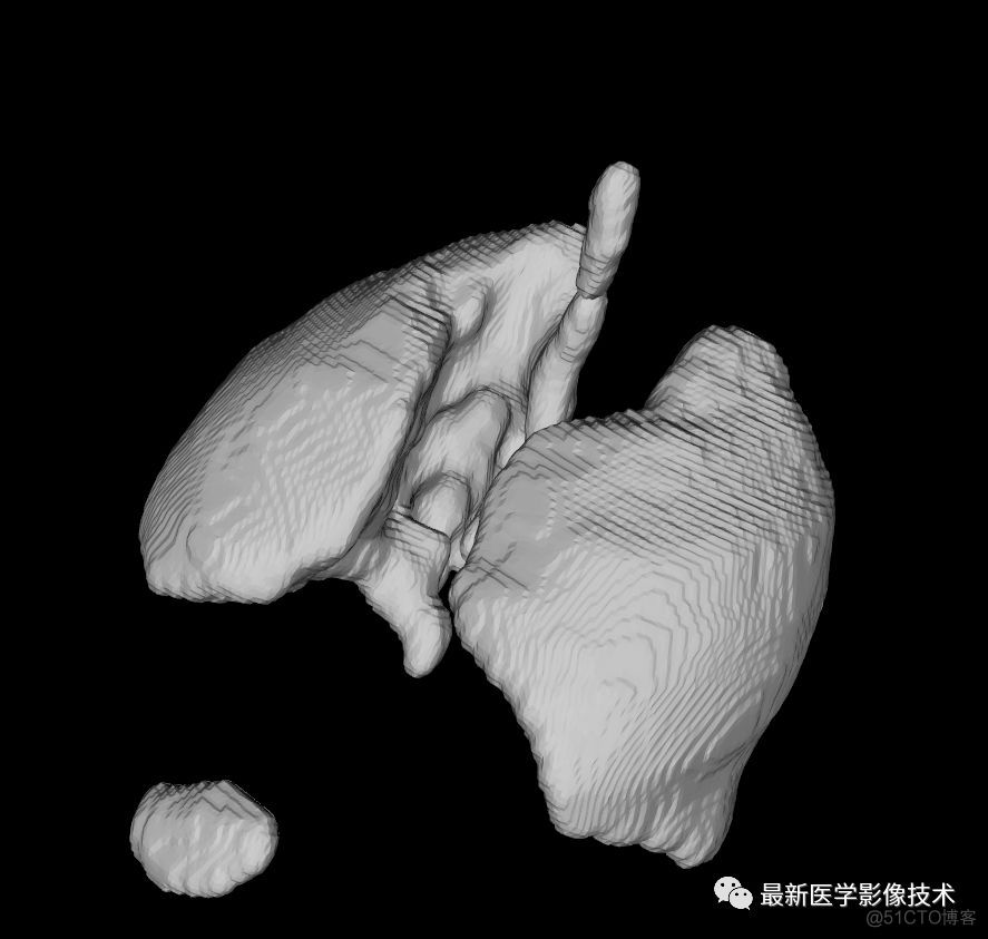 医学图像处理案例（四）——生成人体骨骼和肺组织三维模型_第三方工具_09