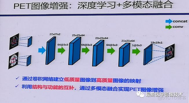 MICS 2018第五届医学图像计算青年研讨会_模态_09