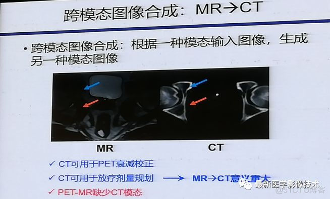 MICS 2018第五届医学图像计算青年研讨会_图像合成_10