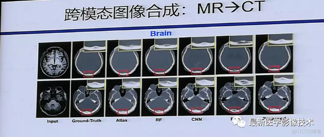 MICS 2018第五届医学图像计算青年研讨会_模态_12