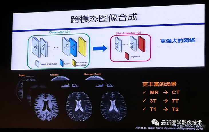 MICS 2018第五届医学图像计算青年研讨会_模态_13