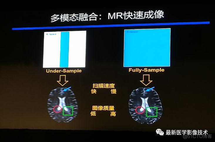 MICS 2018第五届医学图像计算青年研讨会_模态_14