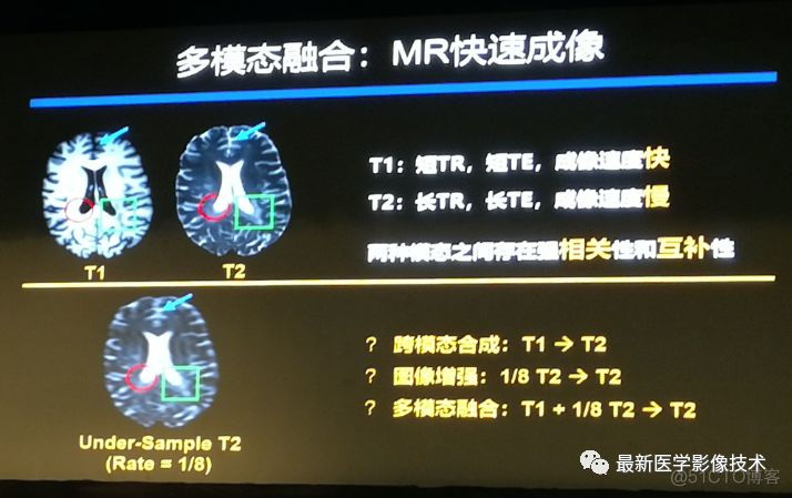 MICS 2018第五届医学图像计算青年研讨会_数据_15