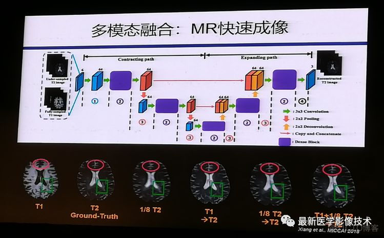 MICS 2018第五届医学图像计算青年研讨会_数据_16