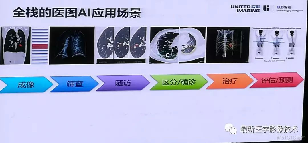 MICS 2018第五届医学图像计算青年研讨会_数据_18