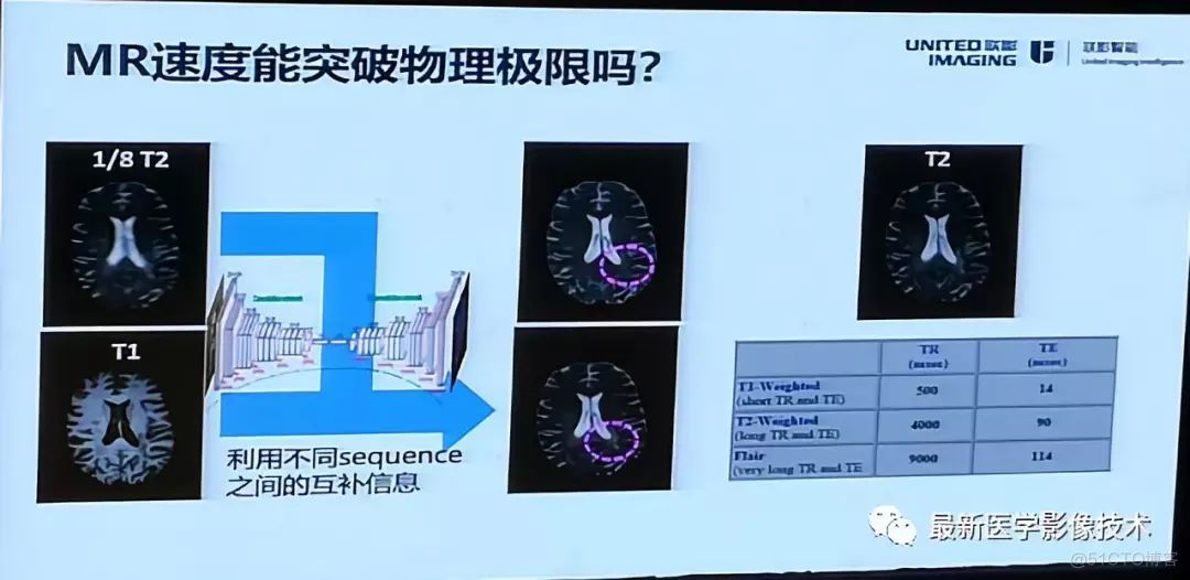 MICS 2018第五届医学图像计算青年研讨会_数据_19