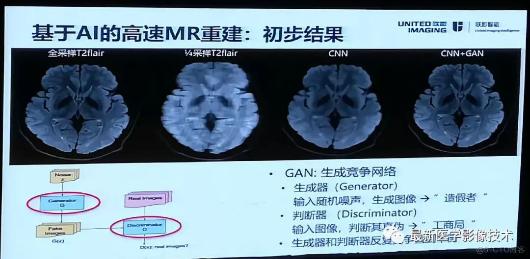 MICS 2018第五届医学图像计算青年研讨会_模态_20