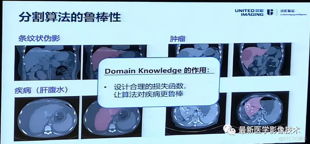 MICS 2018第五届医学图像计算青年研讨会_数据_27