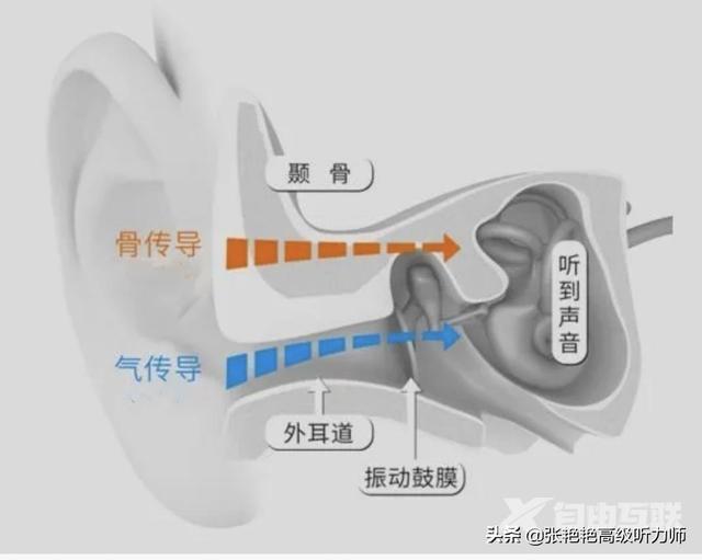 哪种耳机对耳朵伤害最小（耳机哪种最不伤听力）(1)