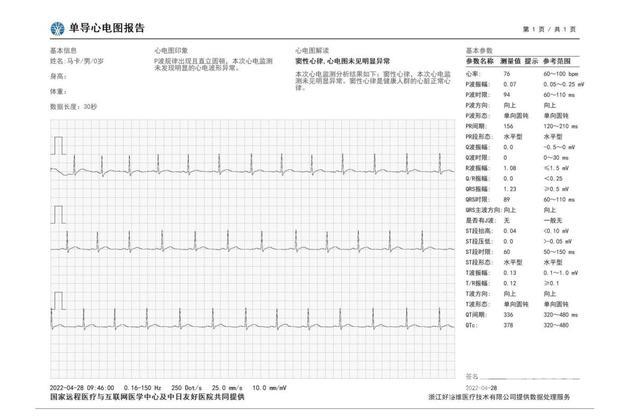 华为手表gt3pro功能介绍（华为watch gt3pro值得买吗）(12)