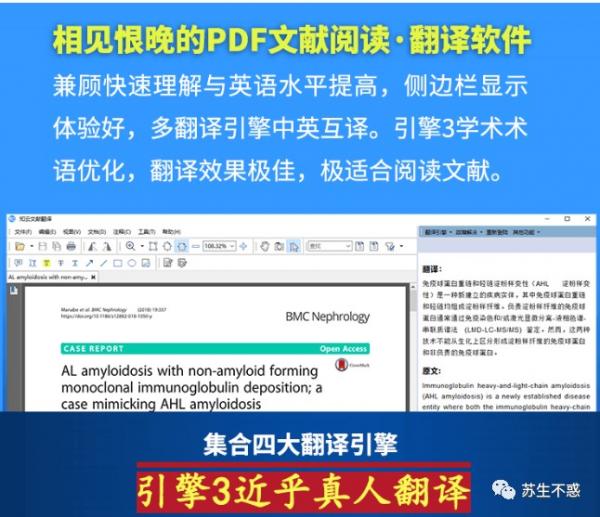 包含macbook知云文献翻译下载的词条