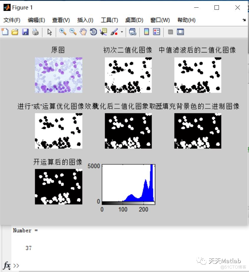 【细胞分割】基于中值滤波和分水岭法实现细胞计数含Matlab源码_二值化