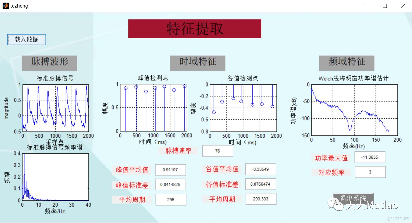 【信号处理】脉搏信号处理系统含Matlab源码_中值滤波_04