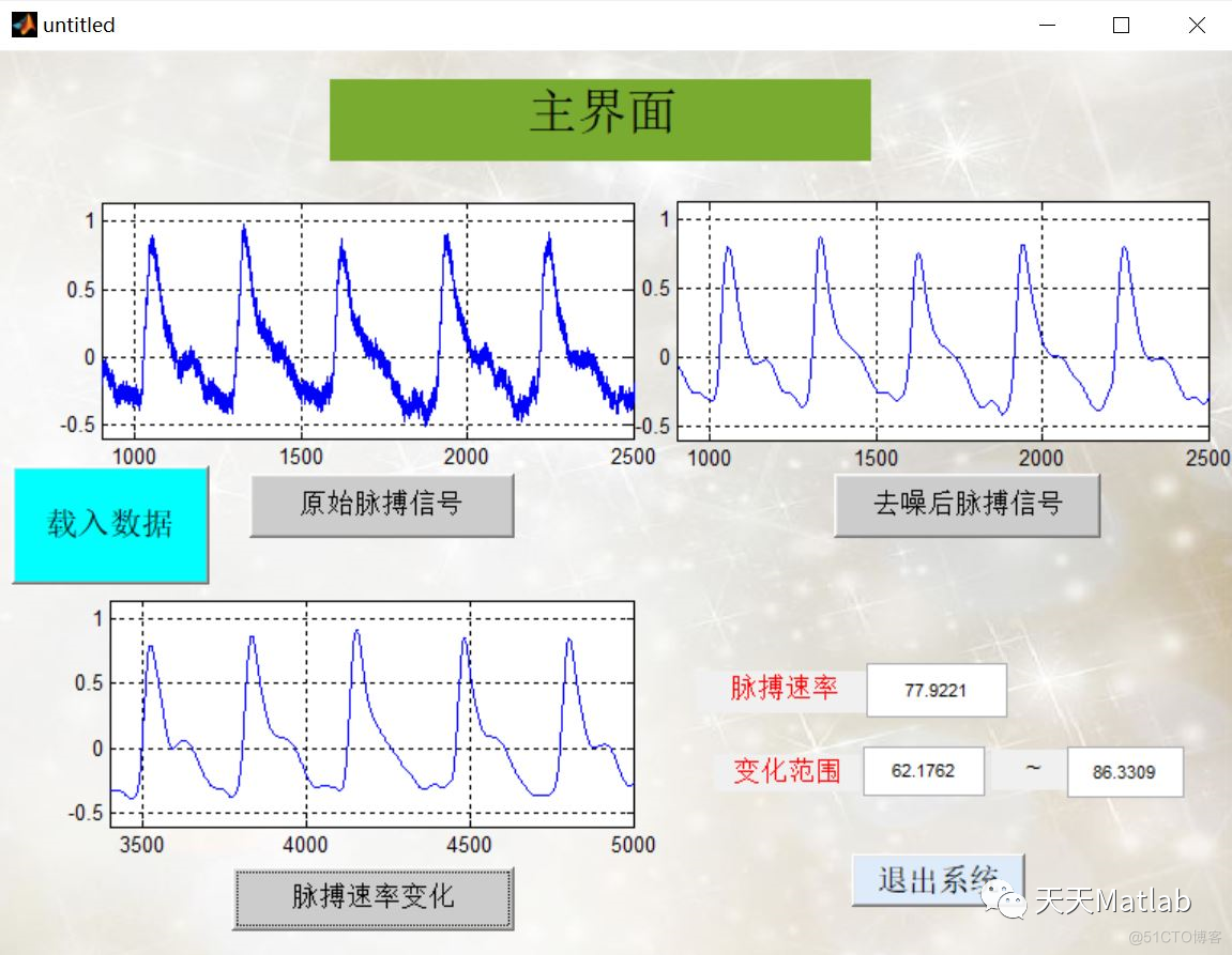 【信号处理】脉搏信号处理系统含Matlab源码_ide