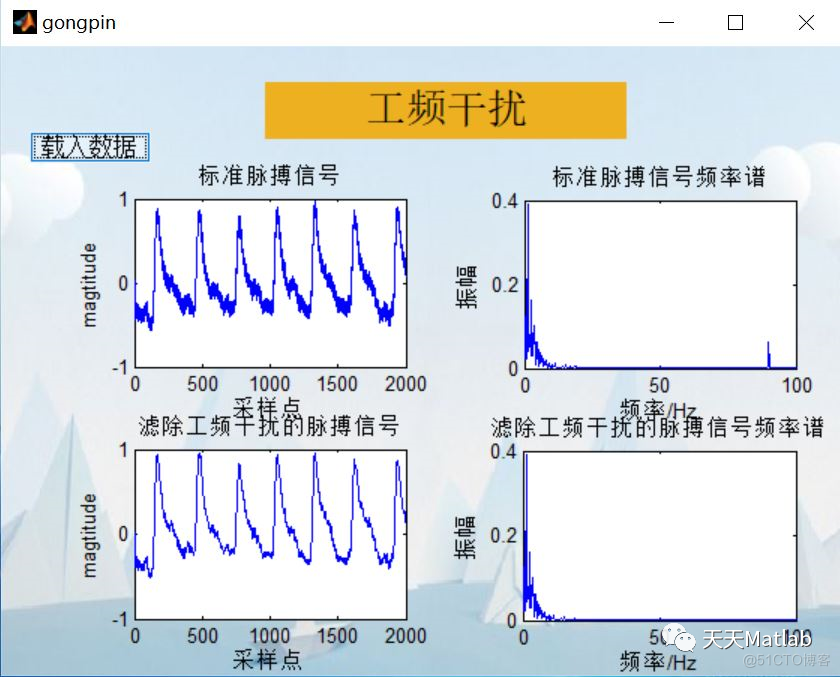 【信号处理】脉搏信号处理系统含Matlab源码_ide_02