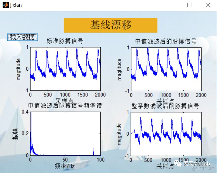 【信号处理】脉搏信号处理系统含Matlab源码_ide_03