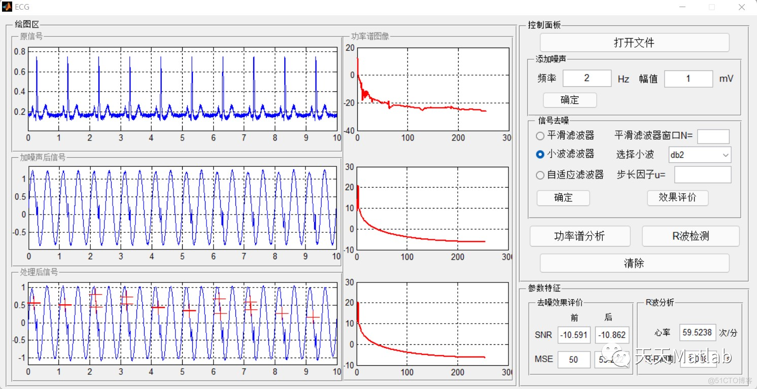 【信号去噪】基于自适应滤波+平滑滤波+小波滤波实现心电信号去噪处理含Matlab源码_差分