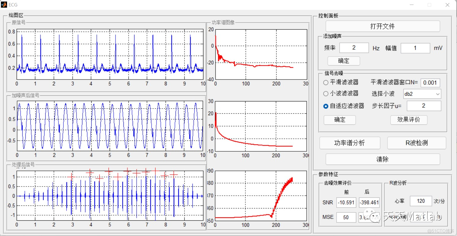 【信号去噪】基于自适应滤波+平滑滤波+小波滤波实现心电信号去噪处理含Matlab源码_去噪_02