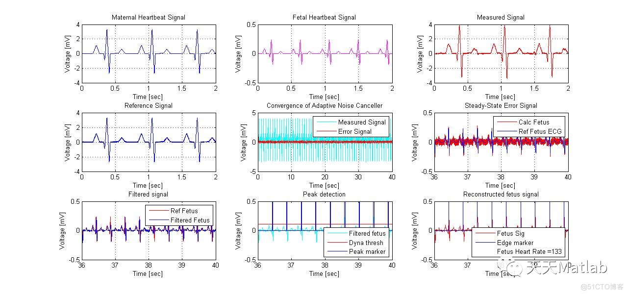 【特征提取】胎儿心电信号提取含Matlab源码_参考文献