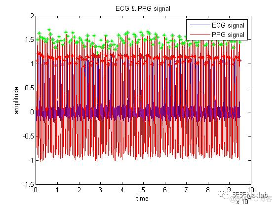 【特征提取】心电信号PTT+HRV+PRV含Matlab源码_参考文献