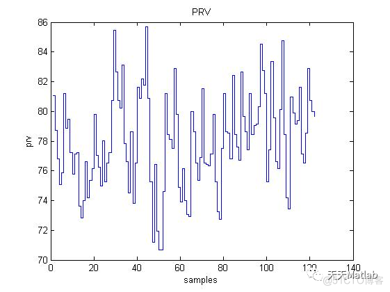 【特征提取】心电信号PTT+HRV+PRV含Matlab源码_无人机_02