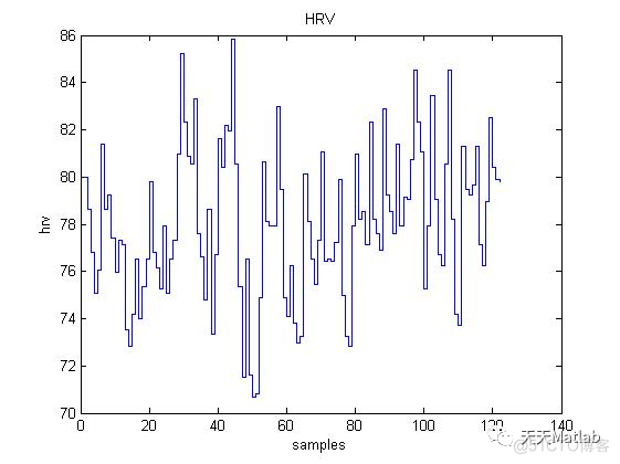 【特征提取】心电信号PTT+HRV+PRV含Matlab源码_图像处理_03