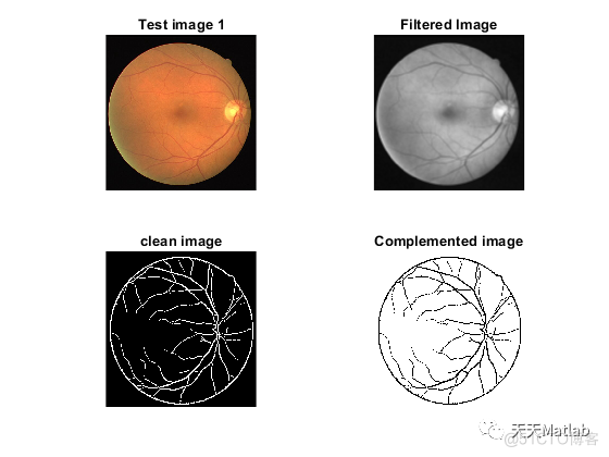 【图像分割】基于计算机视觉实现视网膜图像中的血管分割附matlab代码_matlab代码_03