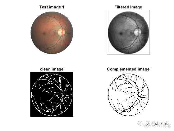 【图像分割】基于计算机视觉实现视网膜图像中的血管分割附matlab代码_图像处理