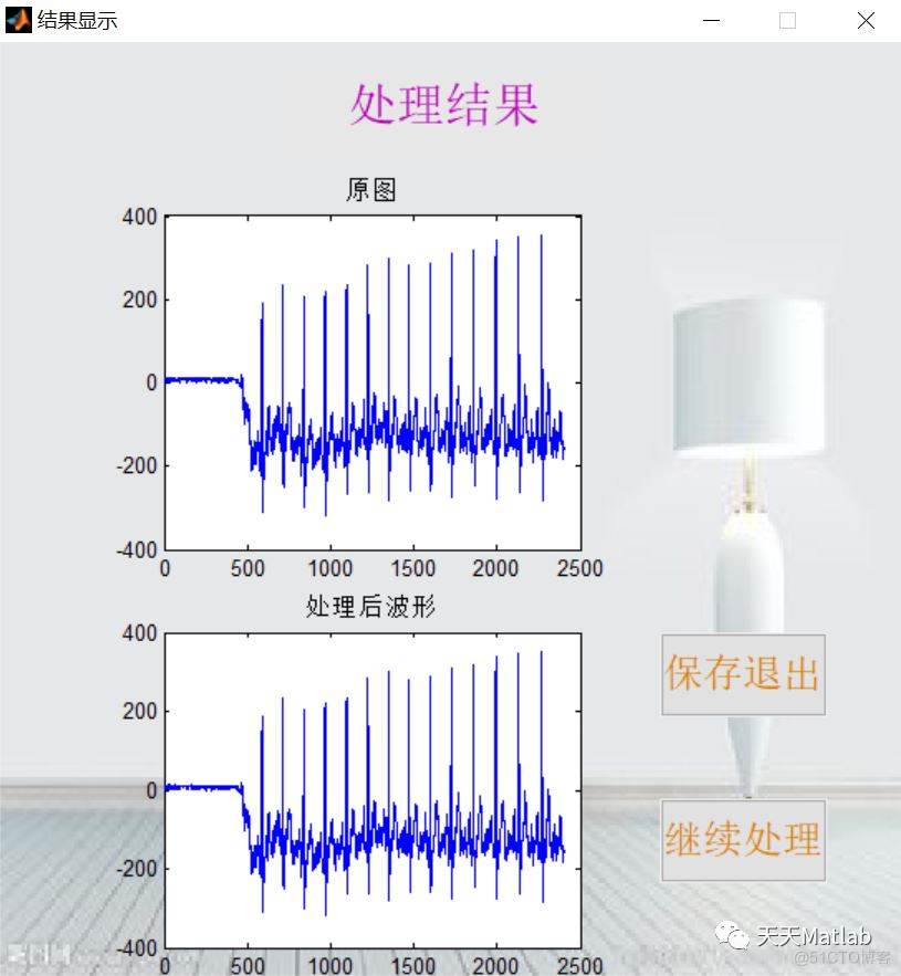 【信号去噪】基于小波变换、中值滤波多种算法实现心电信号预处理含Matlab源码_预处理_07