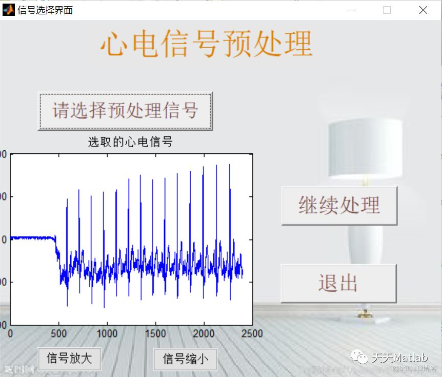 【信号去噪】基于小波变换、中值滤波多种算法实现心电信号预处理含Matlab源码_ide_03