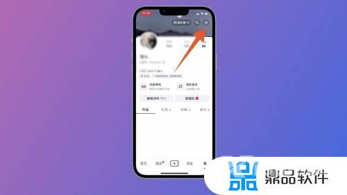 抖音上怎么挂小黄车(抖音上怎么挂小黄车怎么样)