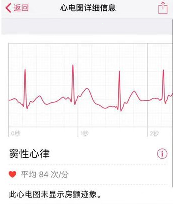 Apple Watch怎样查看心电图?Apple Watch查看心电图的方法步骤截图