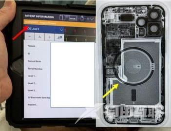 苹果iPhone12实测可逼停心脏除颤器