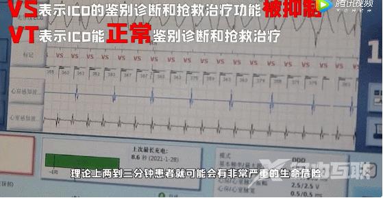 苹果iPhone12实测可逼停心脏除颤器