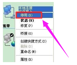 win7电脑本地连接受限制或无连接怎么办(3)