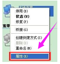 win7电脑本地连接受限制或无连接怎么办(4)