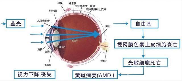 护眼显示器有用吗 护眼显示器效果介绍