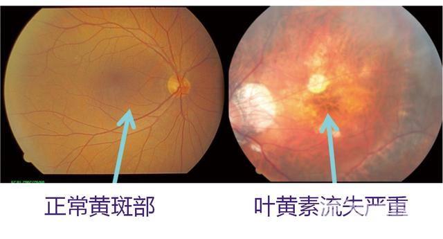 护眼显示器有用吗 护眼显示器效果介绍